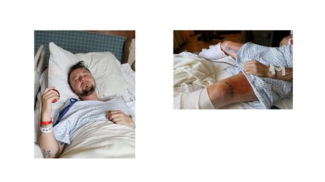 ftm bottom surgery result pictures|Transmasculine Bottom Surgery Results .